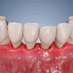 🦷Gel de réparation parodontale Healrize® GumRevive (pour les saignements et la rétraction des gencives ainsi que le déchaussement des dents)🐳