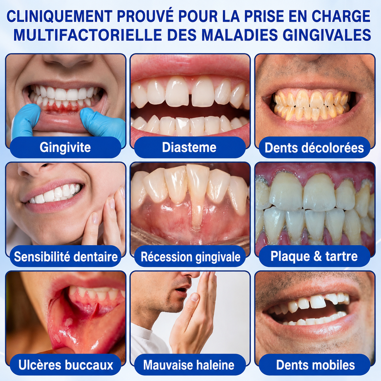 🦷Gel de réparation parodontale Healrize® GumRevive (pour les saignements et la rétraction des gencives ainsi que le déchaussement des dents)🐳