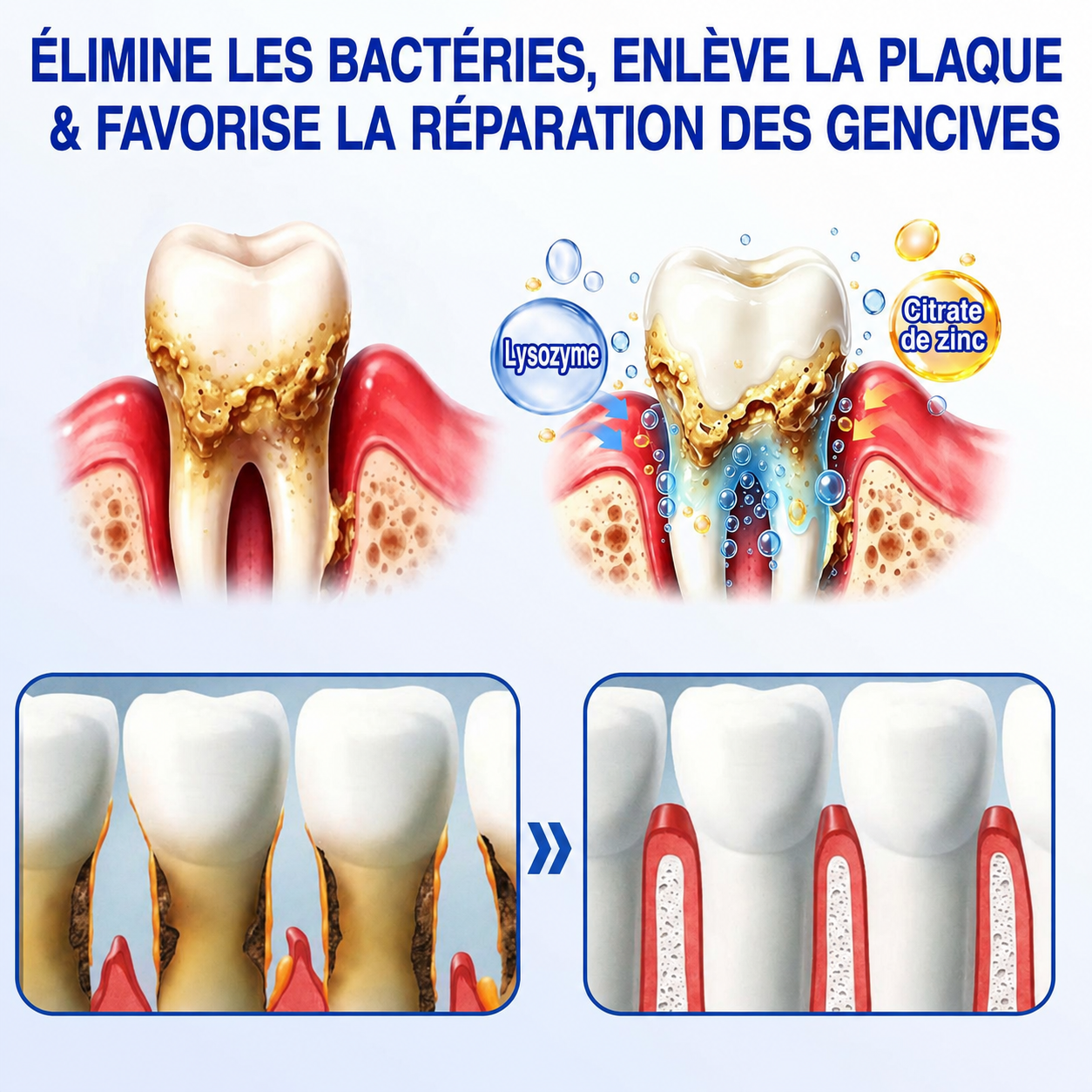 🦷Gel de réparation parodontale Healrize® GumRevive (pour les saignements et la rétraction des gencives ainsi que le déchaussement des dents)🐳
