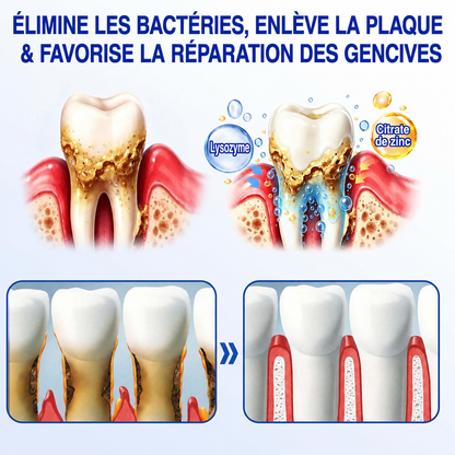 🦷Gel de réparation parodontale Healrize® GumRevive (pour les saignements et la rétraction des gencives ainsi que le déchaussement des dents)🐳