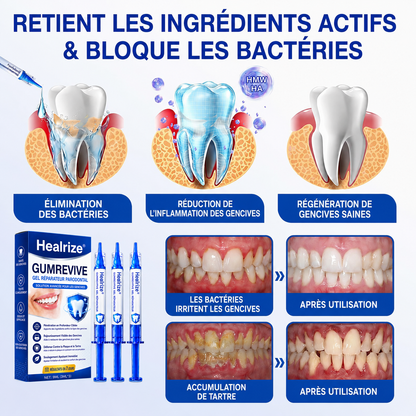 🦷Gel de réparation parodontale Healrize® GumRevive (pour les saignements et la rétraction des gencives ainsi que le déchaussement des dents)🐳